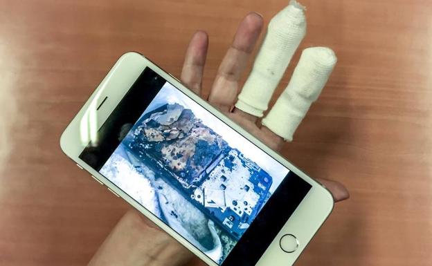 N.R. muestra su mano herida mientras sostiene una foto del móvil calcinado. /IÑAKI ANDRÉS